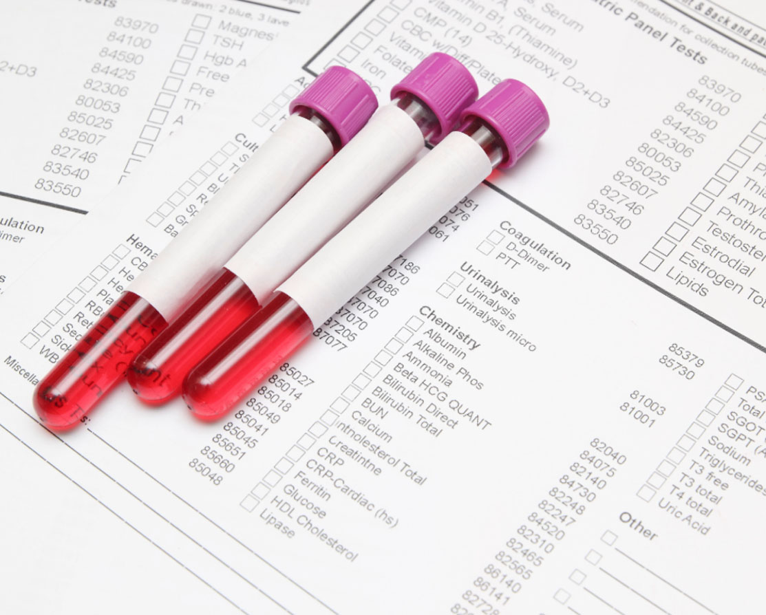 Wellness blood draw photo